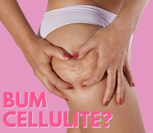 how to get rid of bum cellulite